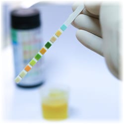 Photo of a urine strip test