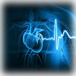 Atrial Fibrillation Illustration