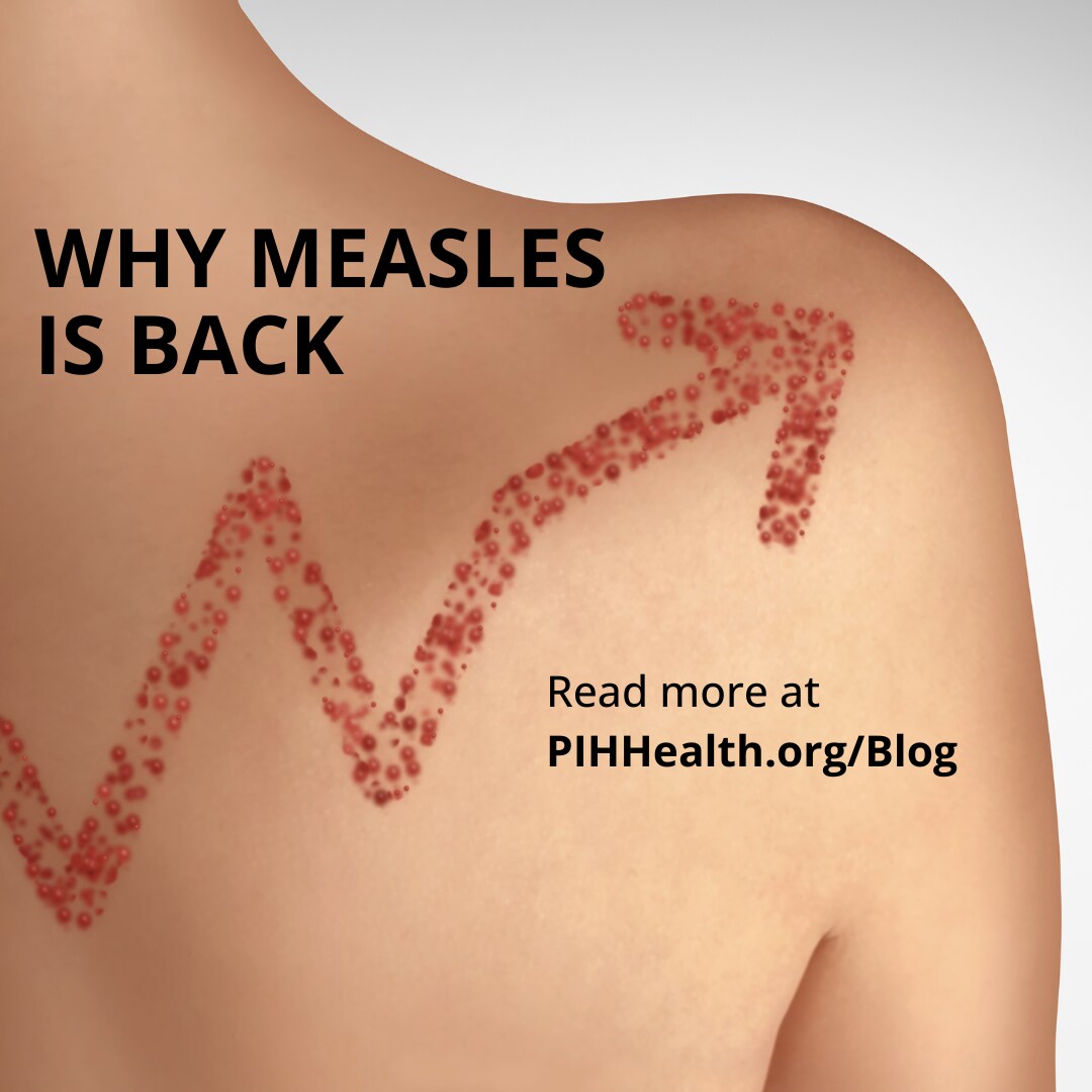 Blog Graphic for Measles Blog