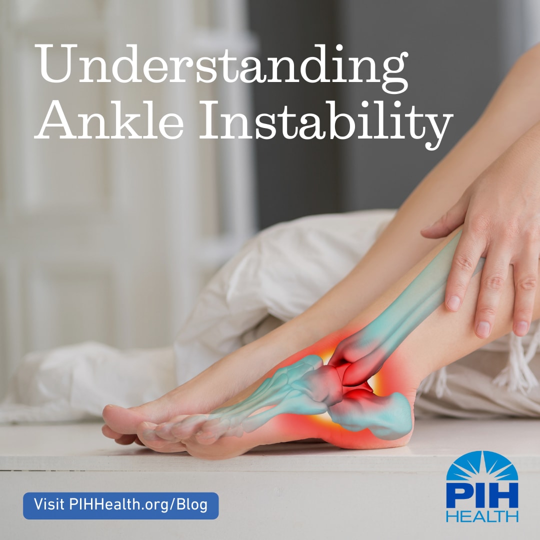 Photo of unstable ankle