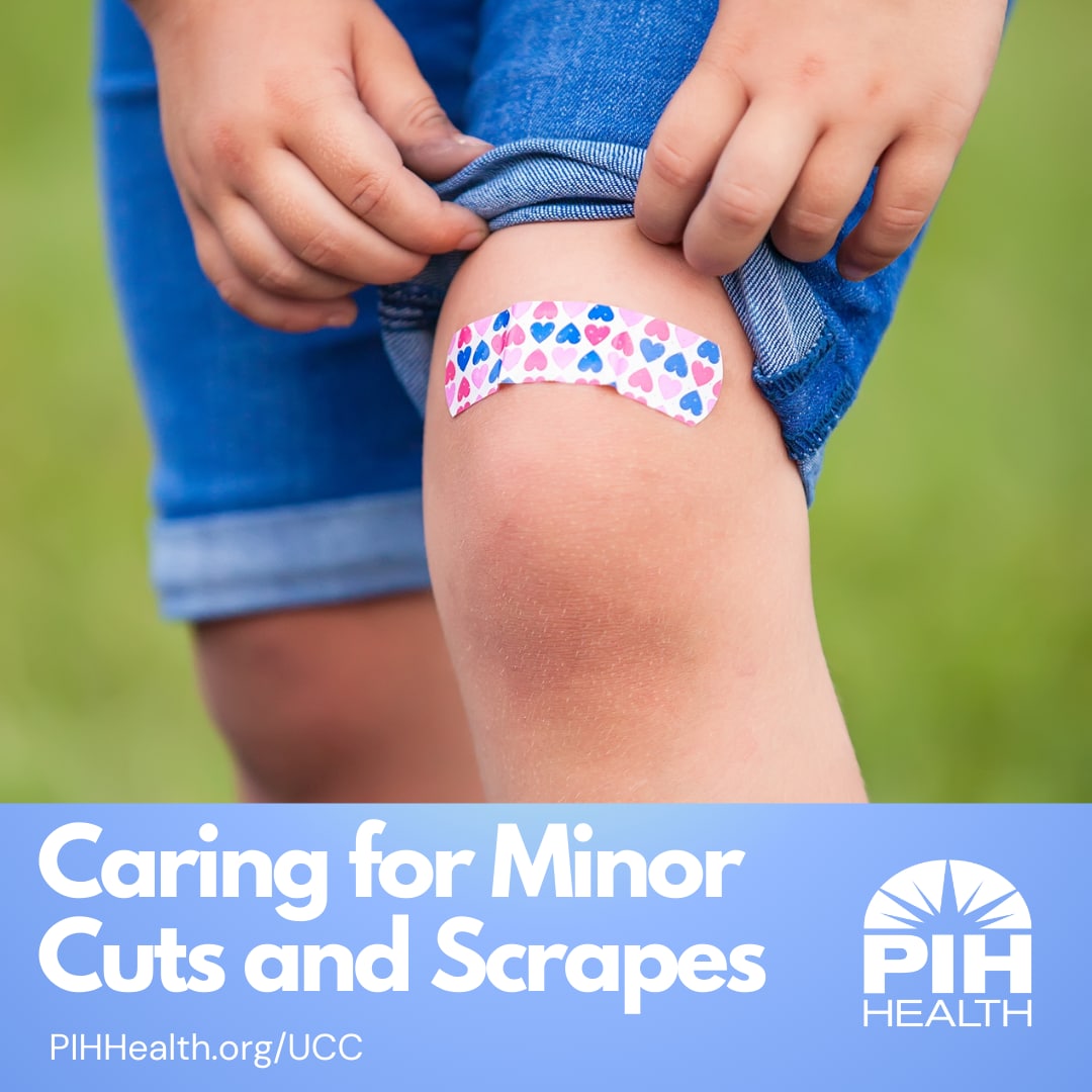 Photo of a child knee with a colorful bandaid on it