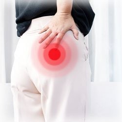 Photo of location of sciatica pain