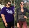 Photo of bariatric patient before and after