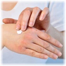 Photo of Hands with Dry Skin